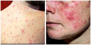 InCollage_20260404_124535980