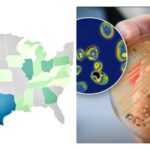 A drug-resistant fungal ‘superbug’ has infected people across 23 U.S. states