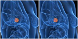 InCollage_20241208_205725950