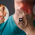 Oral sex has overtaken smoking as the primary driver of throat cancer.