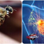 Honeybee venom could indeed induce 100% cancer cell death in certain aggressive breast cancer subtypes within 60 minutes